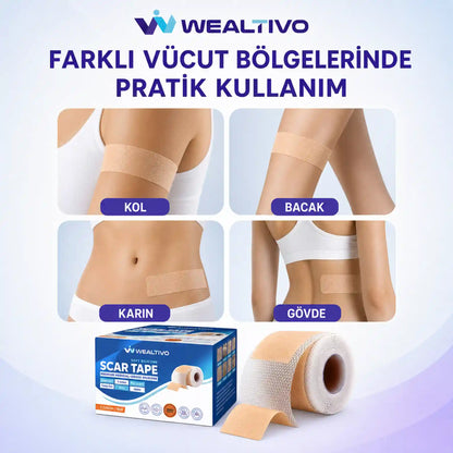 Wealtivo Premium Soft Silikon Bant 3m