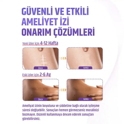 Premium Soft Silikon Yara İzi Bandı