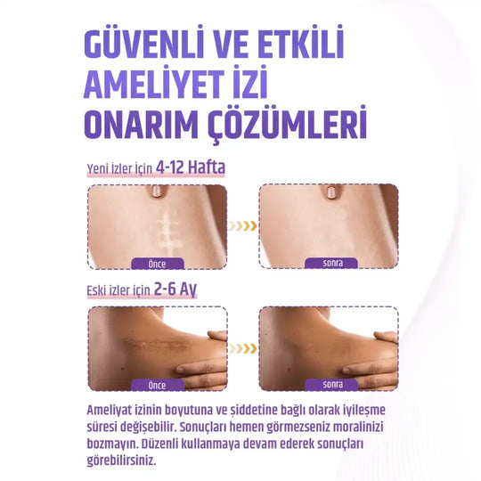 Premium Soft Silikon Yara İzi Bandı