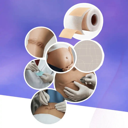 Premium Soft Silikon Yara İzi Bandı